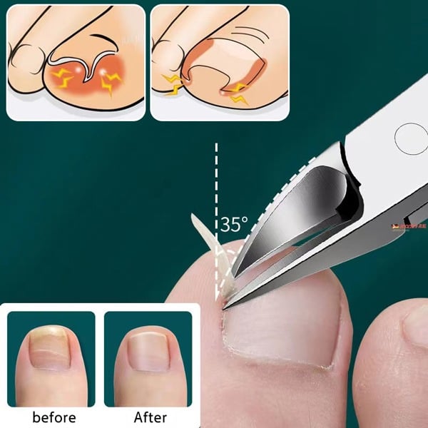 Cumuul Nagelknipser
