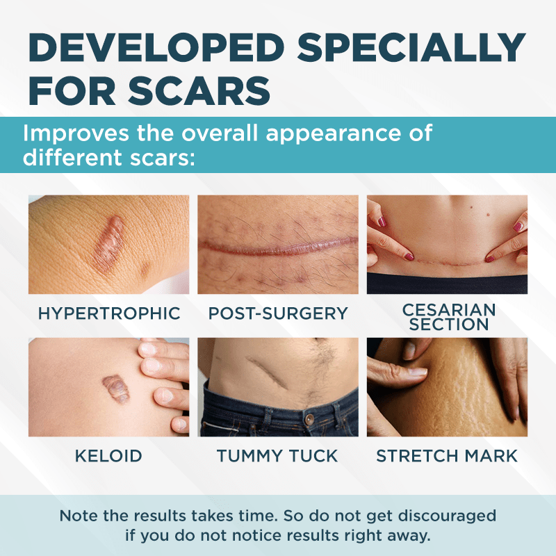 ClearScar™ Advanced Scar Reduction Gel