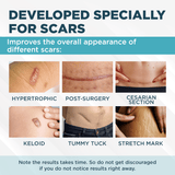 ClearScar™ Advanced Scar Reduction Gel