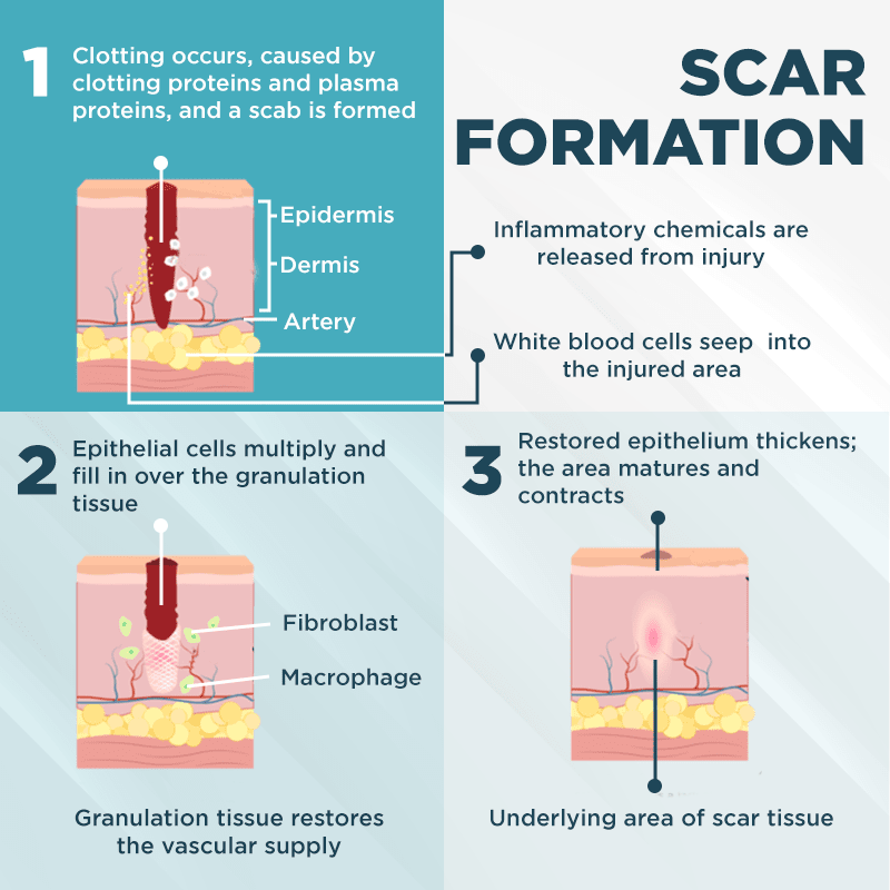 ClearScar™ Advanced Scar Reduction Gel