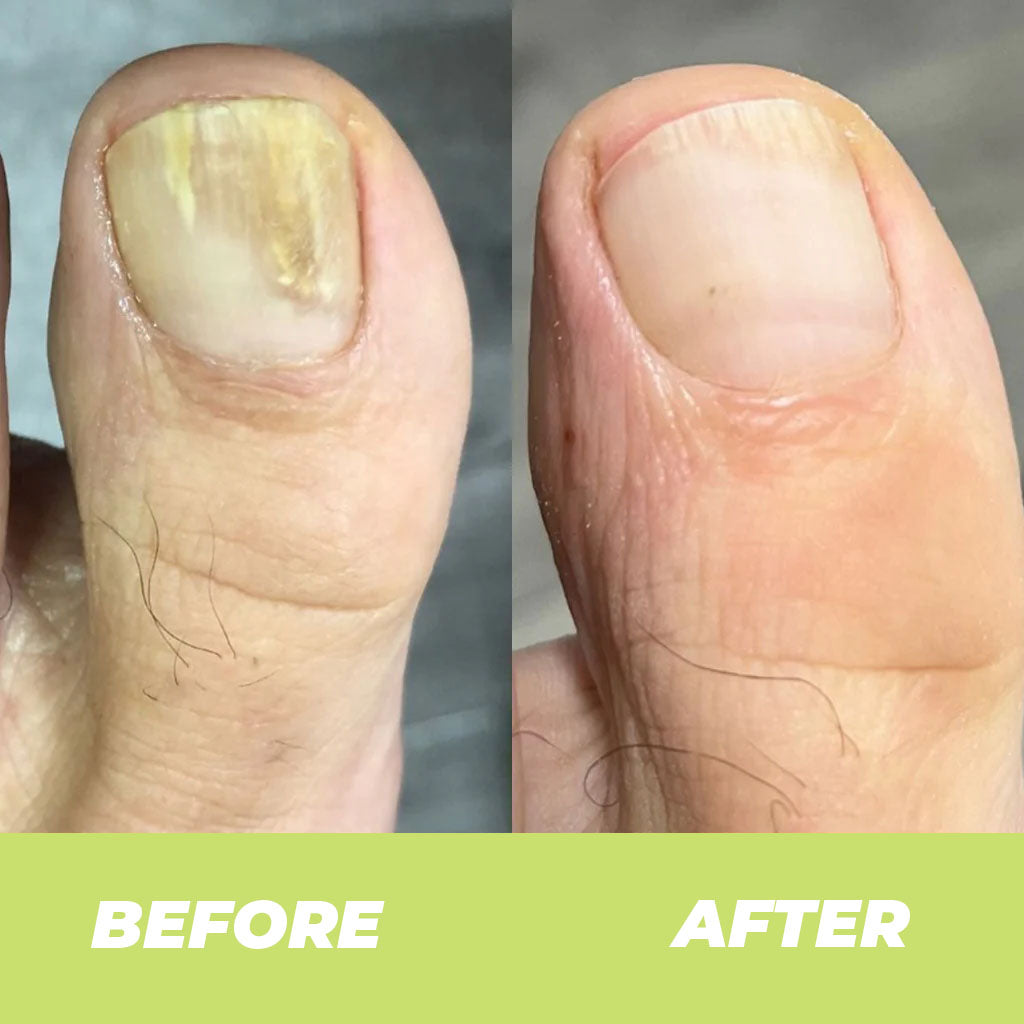 Nail Treatment Repair Gel