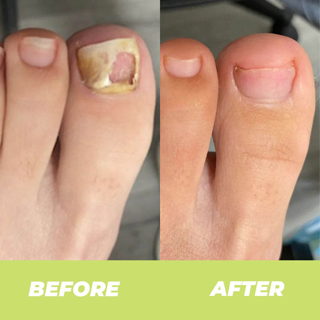Nail Treatment Repair Gel