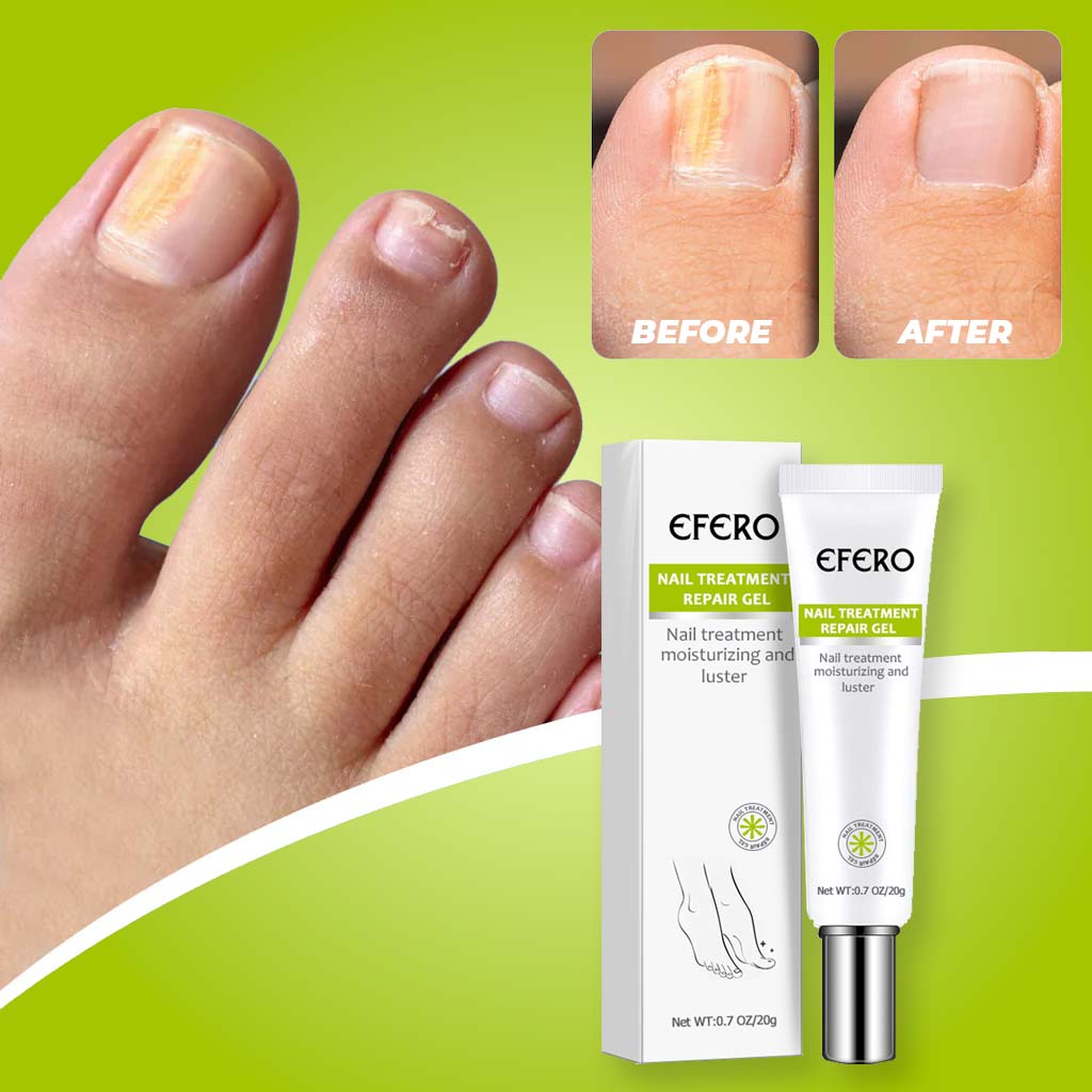 Nail Treatment Repair Gel